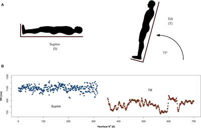 Heart Rate Asymmetry Analysis During Head-Up Tilt Test in Healthy Men